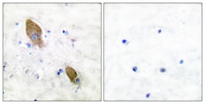 PYK2 (Phospho-Tyr881) antibody