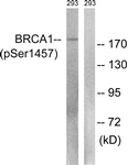 BRCA1 (Phospho-Ser1457) antibody