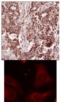 NFkB p105 / p50 (phospho Ser927) Antibody