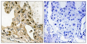 p53 (Phospho-Thr387) antibody