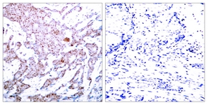 NF-kappaB p65 (Phospho-Ser536) antibody