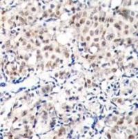 p27Kip1 (phospho Thr187) Antibody