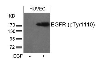 EGFR (phospho Tyr1110) Antibody