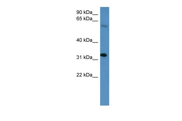 Hoxd13 antibody - C-terminal region