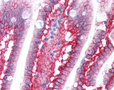 Beta Catenin Antibody