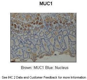 MUC1 antibody - middle region