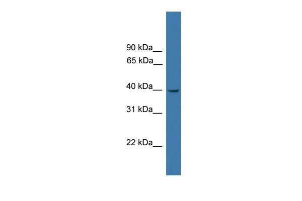 LTB4R antibody - C-terminal region