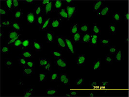 NFX1 Antibody (monoclonal) (M01)