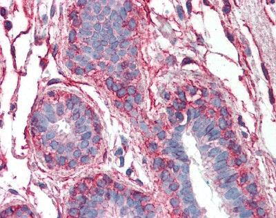 PAK1 Antibody