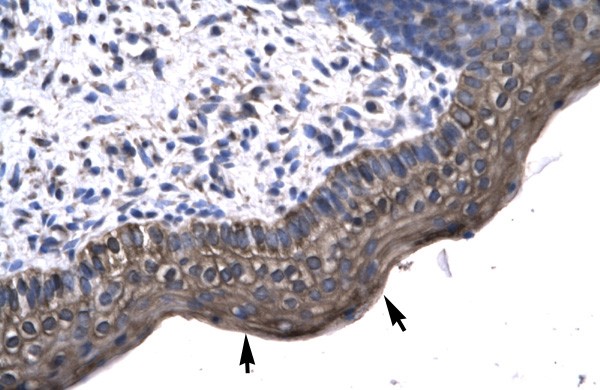 KIN antibody - middle region