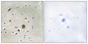 MEK1 antibody