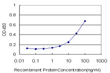 MEOX1 Antibody (monoclonal) (M07)