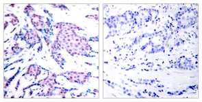 c-Jun (Phospho-Thr93) antibody