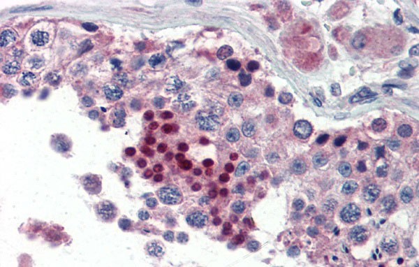NR0B1 antibody