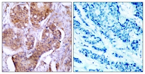 Estrogen Receptor-alpha (Phospho-Ser106) antibody