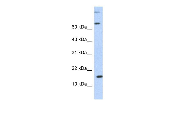 CCL7 antibody
