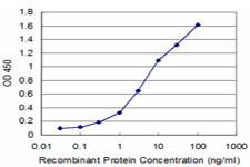 MSI1 Antibody (monoclonal) (M05)