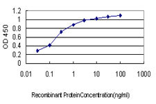 LTBP2 Antibody (monoclonal) (M01)