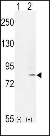 FGFR1-Y307 Antibody