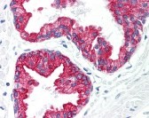 KRT8 Antibody
