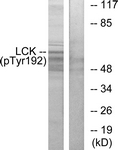 Lck (Phospho-Tyr192) antibody