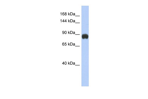 GRM6 antibody - middle region