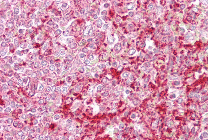 ETV5 antibody - N-terminal region