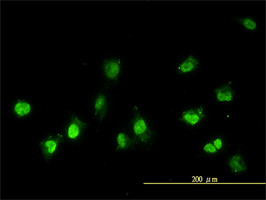 NEK11 Antibody (monoclonal) (M01)