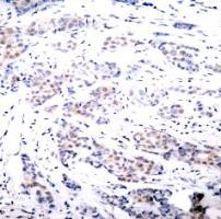 Elk 1 Antibody