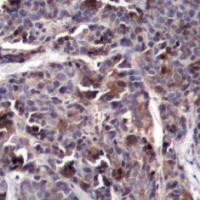 NFkB p65 (phospho Thr505) Antibody