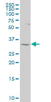 NKX6-1 Antibody (monoclonal) (M02)