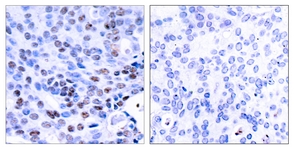 NF-kappaB p105/p50 antibody