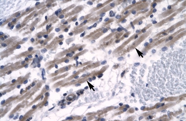 ZNF391 antibody - N-terminal region