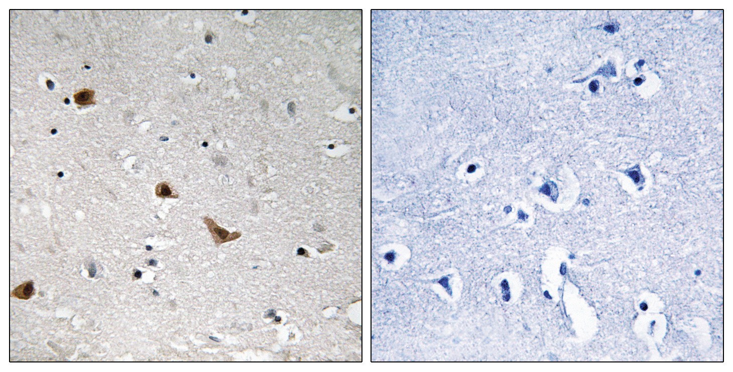 IKK-γ (phospho Ser376) Antibody