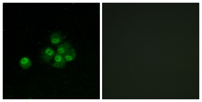 IRS-1 (Phospho-Ser636) antibody