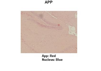 APP antibody - middle region