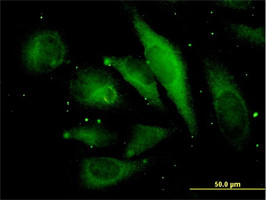 MAPRE2 Antibody (monoclonal) (M03)