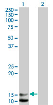 NPPB Antibody (monoclonal) (M01)