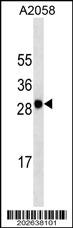 MART-1/Melan-A Antibody (C-term) (Ascites)