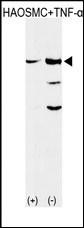 NDRG2 Antibody (monoclonal) (M06)