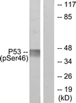 p53 (Phospho-Ser46) antibody