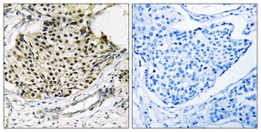 IKK-gamma (Phospho-Ser31) antibody
