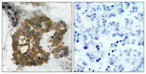 Akt2 (Phospho-Ser474) antibody