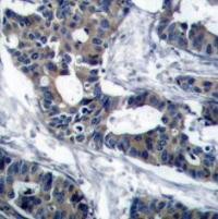 MEK1 Antibody