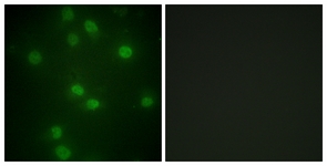 Retinoblastoma (Phospho-Ser811) antibody