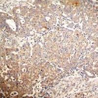 Keratin 18 (phospho Ser33) Antibody