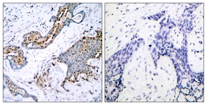 Estrogen Receptor-alpha (Phospho-Ser118) antibody