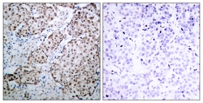 p53 (Phospho-Ser315) antibody