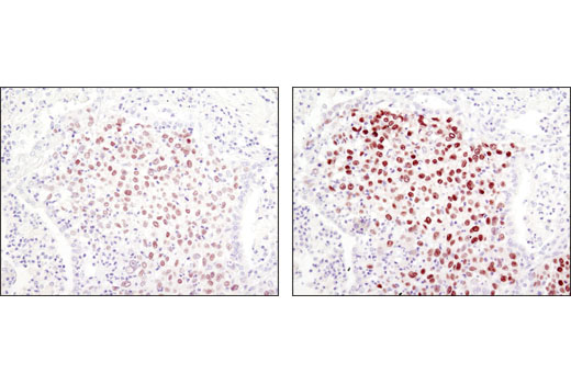 SignalStain ® Boost IHC Detection Reagent (HRP, Rabbit)
