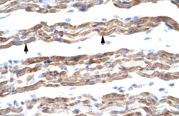 PQBP1 antibody - middle region